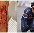 Alpecin-renner overvallen met machete, dader krijgt celstraf