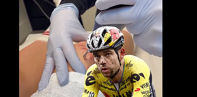 Wout van Aert doet fans afgrijzen én genieten met nieuwste update